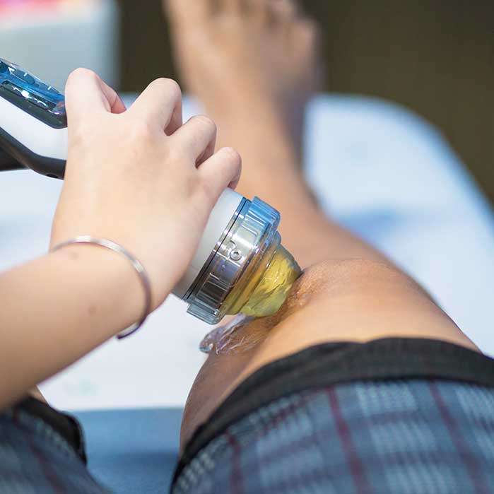 shockwave therapy for auto accident chiropractic treatment in Wilmington